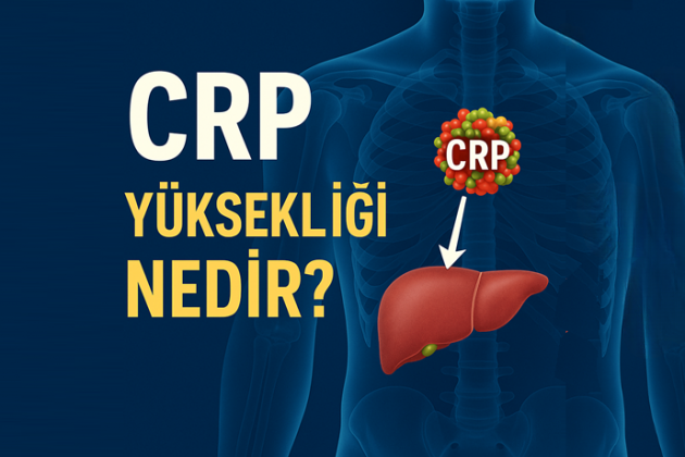 CRP Yüksekliği Nedir? Ne Anlama Gelir, Kaç Olursa Tehlikelidir?