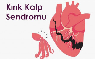 Kırık Kalp Sendromu Nedir? Belirtileri, Nedenleri ve Stresin Kalbe Etkisi