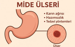 Mide Ülseri Hakkında Bilmeniz Gereken Her Şey